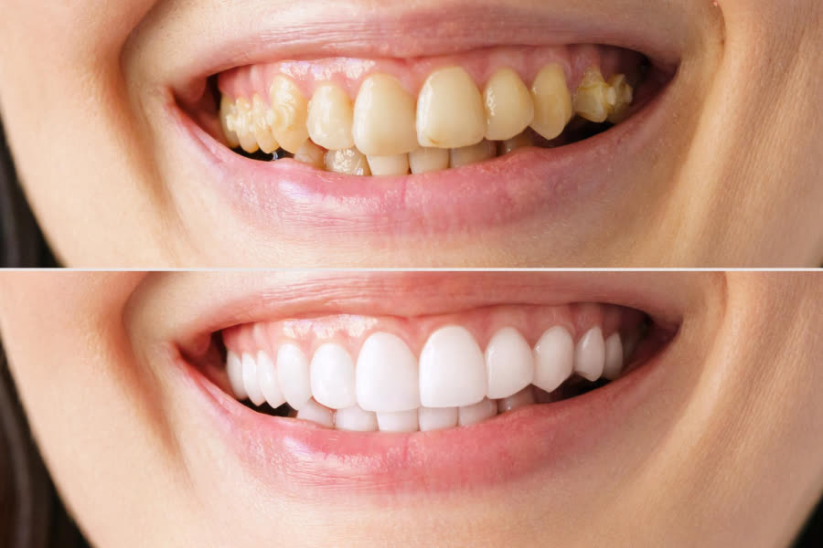 Estetica Dentale