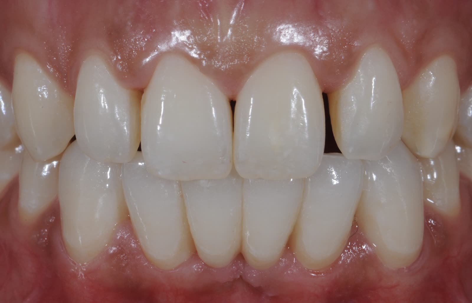 Prevenzione Dentale